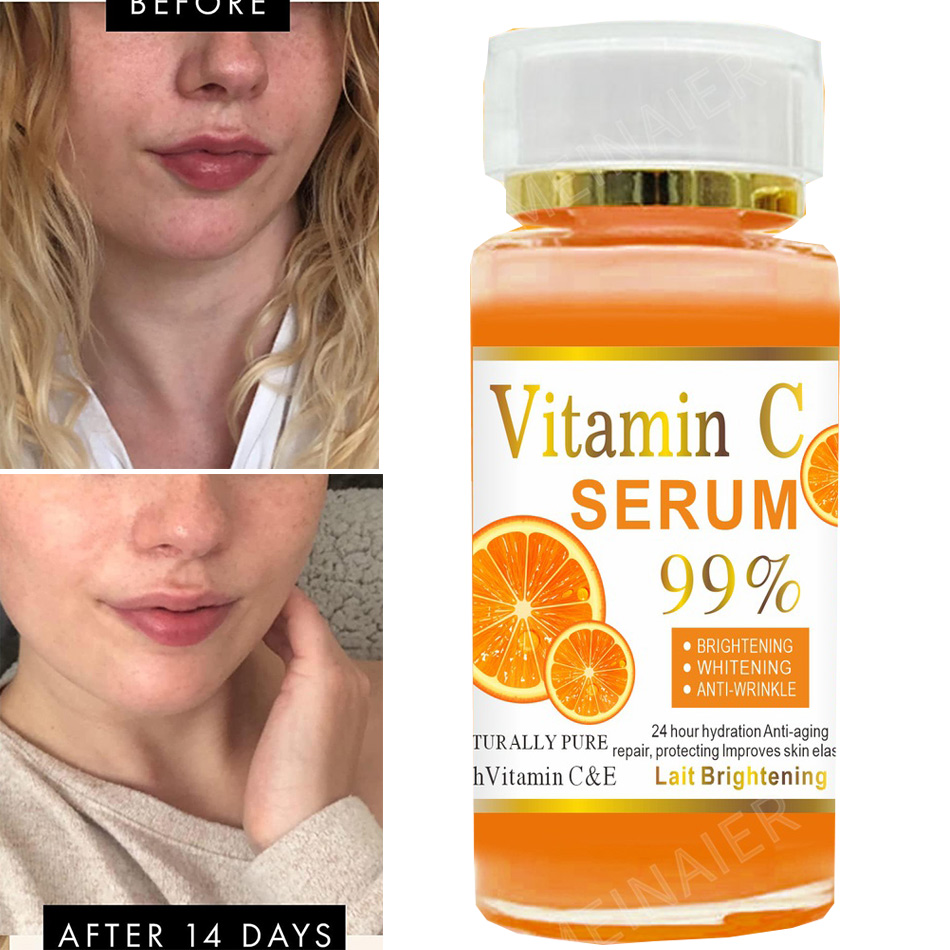 120ml 99% vitamina C suero ace - Skincare Garnier reseña y precio