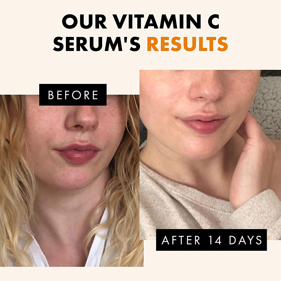 120ml 99% vitamina C suero ace - Skincare Garnier reseña y precio